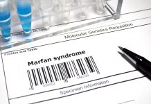 New Marfan syndrome treatment could delay the need for surgery