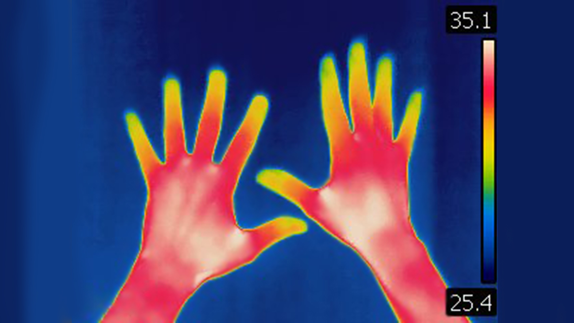 Thermal imaging could improve hand hygiene in hospitals