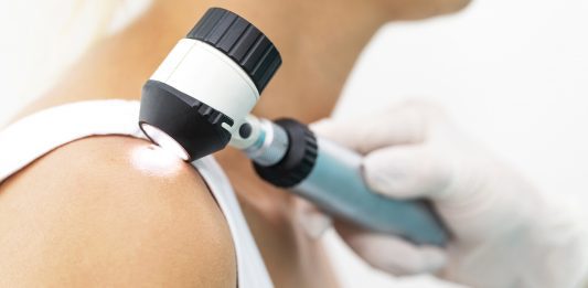 Broad-spectrum antibiotics could make melanoma worse