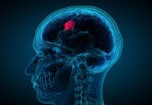 The cause of medulloblastoma relapse has been found by researchers