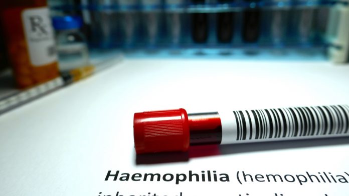 Retraining the immune system to treat haemophilia A
