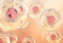 Understanding stem cell transplant complications