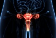UCL researchers make an exciting discovery about cervical cancer 