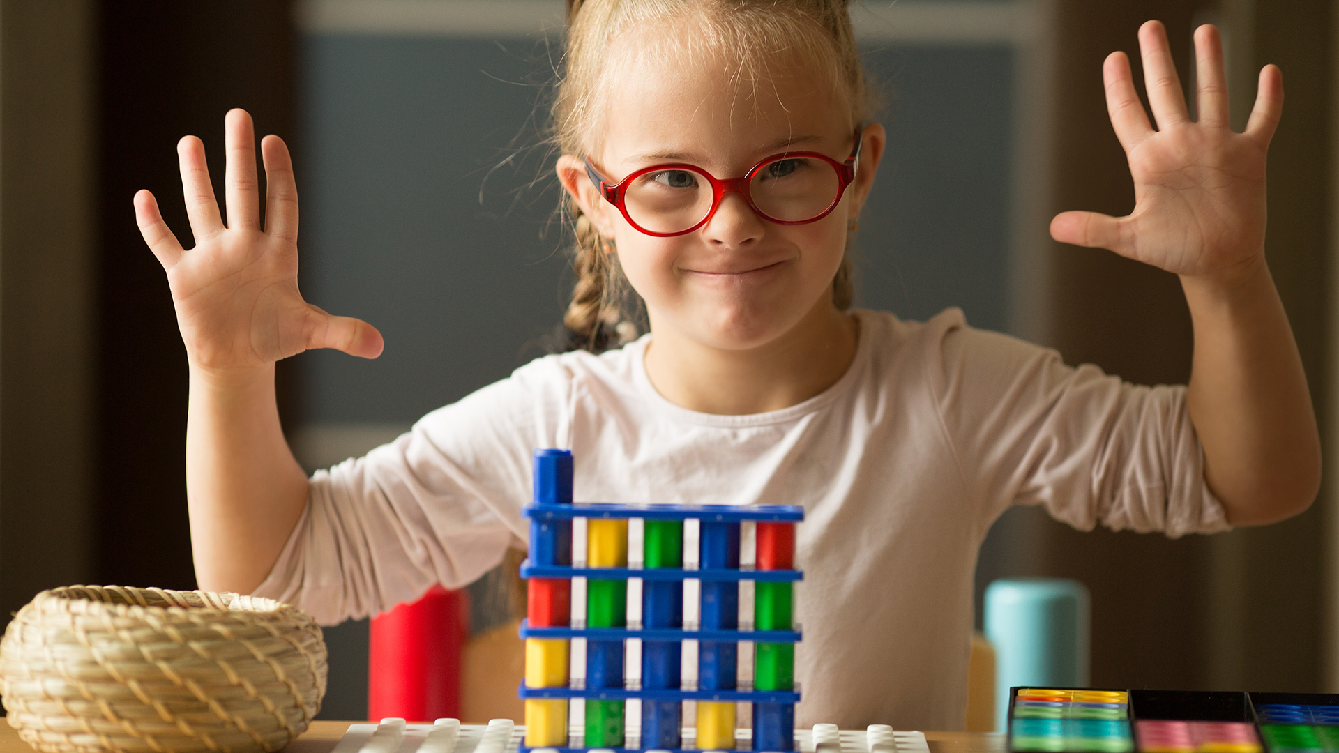 Children with Down’s syndrome are highly susceptible to diabetes