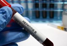 A new discovery could lead to effective hepatitis B treatment