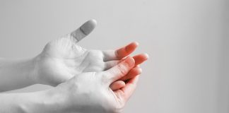 People with diabetes are more susceptible to trigger finger