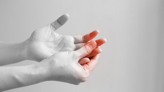 People with diabetes are more susceptible to trigger finger