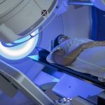 Radiotherapy treatment can only stop cancer recurrence in the short-term