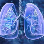 NICE approve mobocertinib to treat aggressive lung cancer