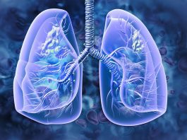 NICE approve mobocertinib to treat aggressive lung cancer