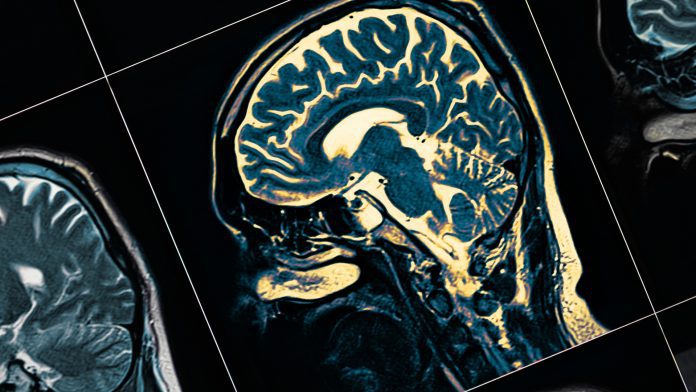 Researchers discover new target for Alzheimer’s treatment