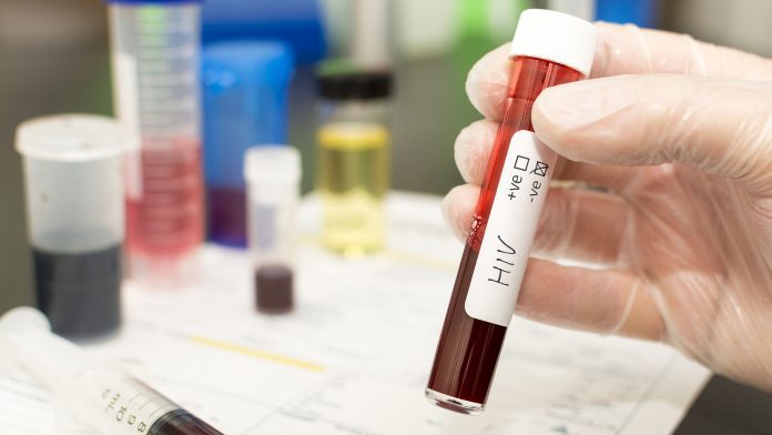 NHS HIV testing identifies hundred more cases 