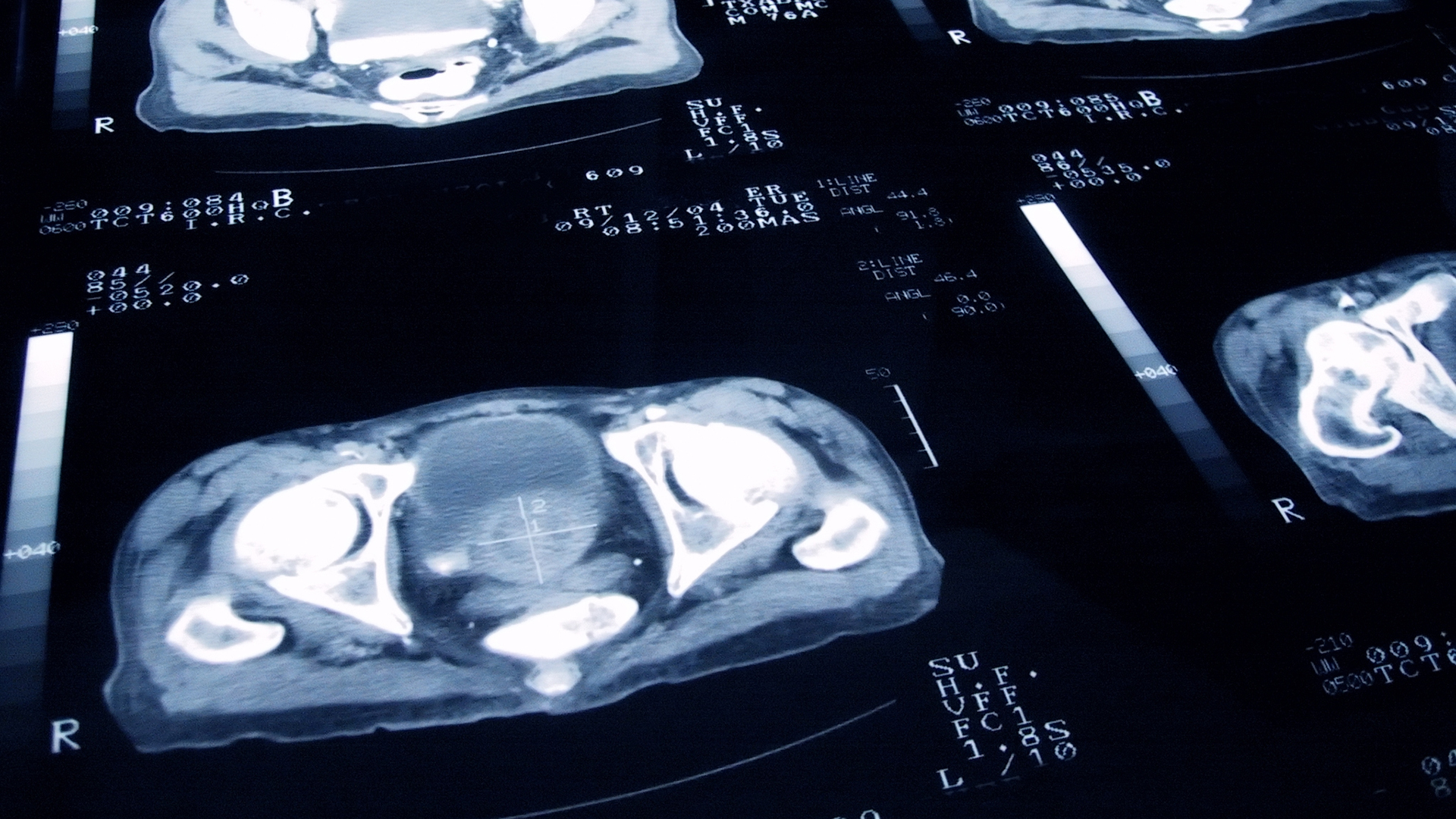 More ethnic diversity is needed in genomic cancer data