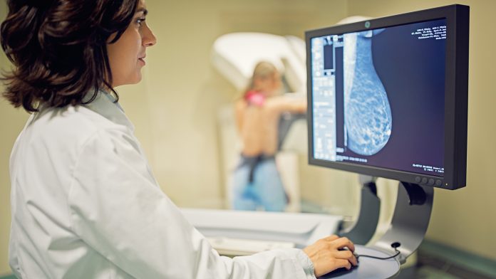 Benign breast disease increases the risk of breast cancer