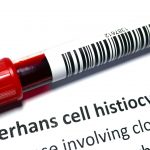Researchers identify origins of Langerhans cell histiocytosis in children