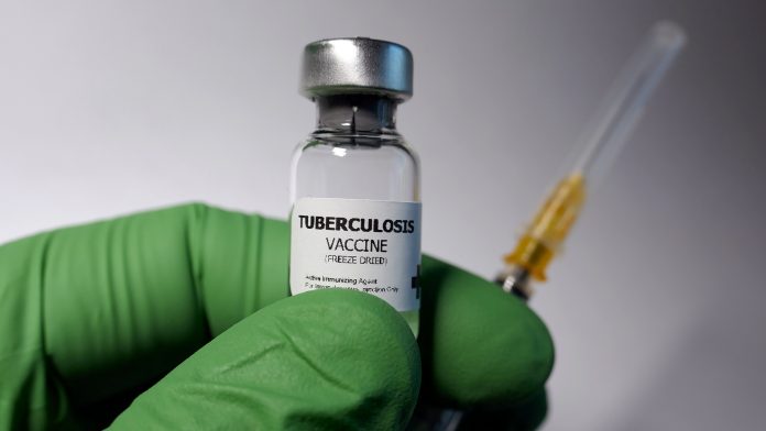 Is it time TB vaccines were improved?