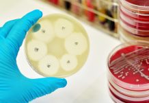 Improving access to antimicrobial diagnostics