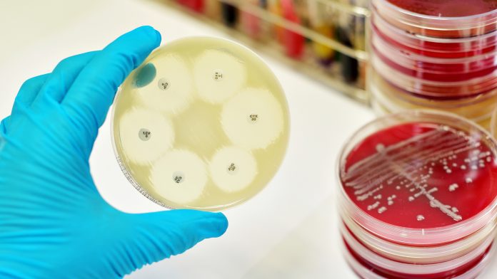 Improving access to antimicrobial diagnostics