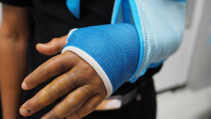 New affordable device for fixing bones trialled in low-income countries