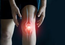 High and low-dose exercise yields similar results for knee osteoarthritis