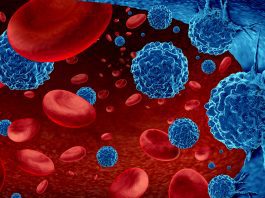 An existing drug could provide a potent treatment for acute leukaemia