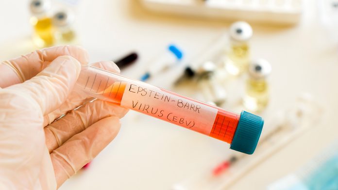New discovery could lead Epstein-Barr virus vaccines