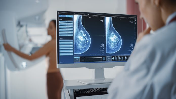 Nearly four in ten women missed out on breast cancer screening