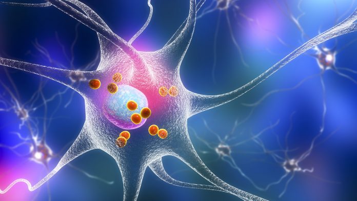 Research into modified RNA could revolutionise Lewy body dementia treatment