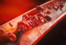 Low-grade inflammation can cause atherosclerosis in healthy adolescents