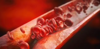 Low-grade inflammation can cause atherosclerosis in healthy adolescents