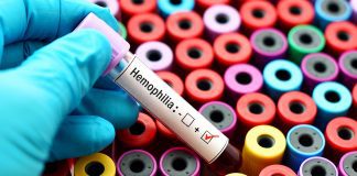 Researchers suggest changes to haemophilia treatment