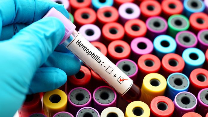 Researchers suggest changes to haemophilia treatment
