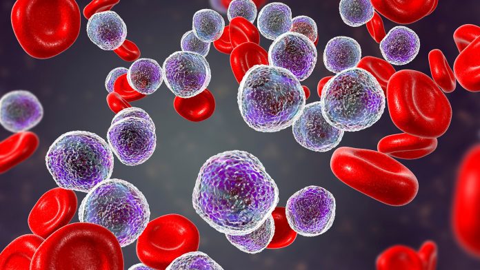 A new targeted treatment for acute myeloid leukaemia has been approved