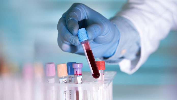 New blood test could save lives of heart attack patients