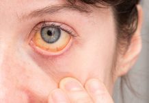 Researchers identify new treatment options for uveal melanoma