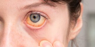Researchers identify new treatment options for uveal melanoma