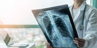 UK lung cancer death rates are predicted to fall in 2023