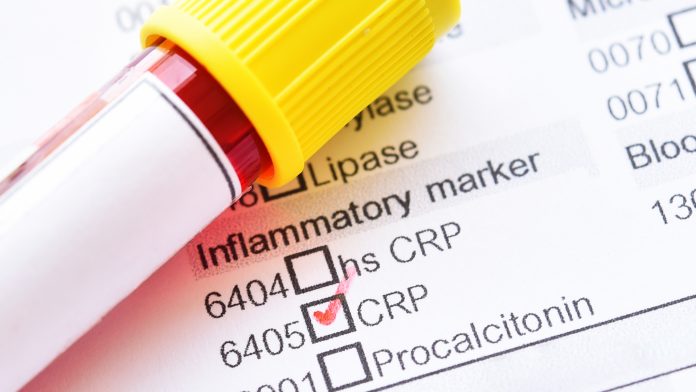 CRP proteins can reduce immune responses in inflammatory disease