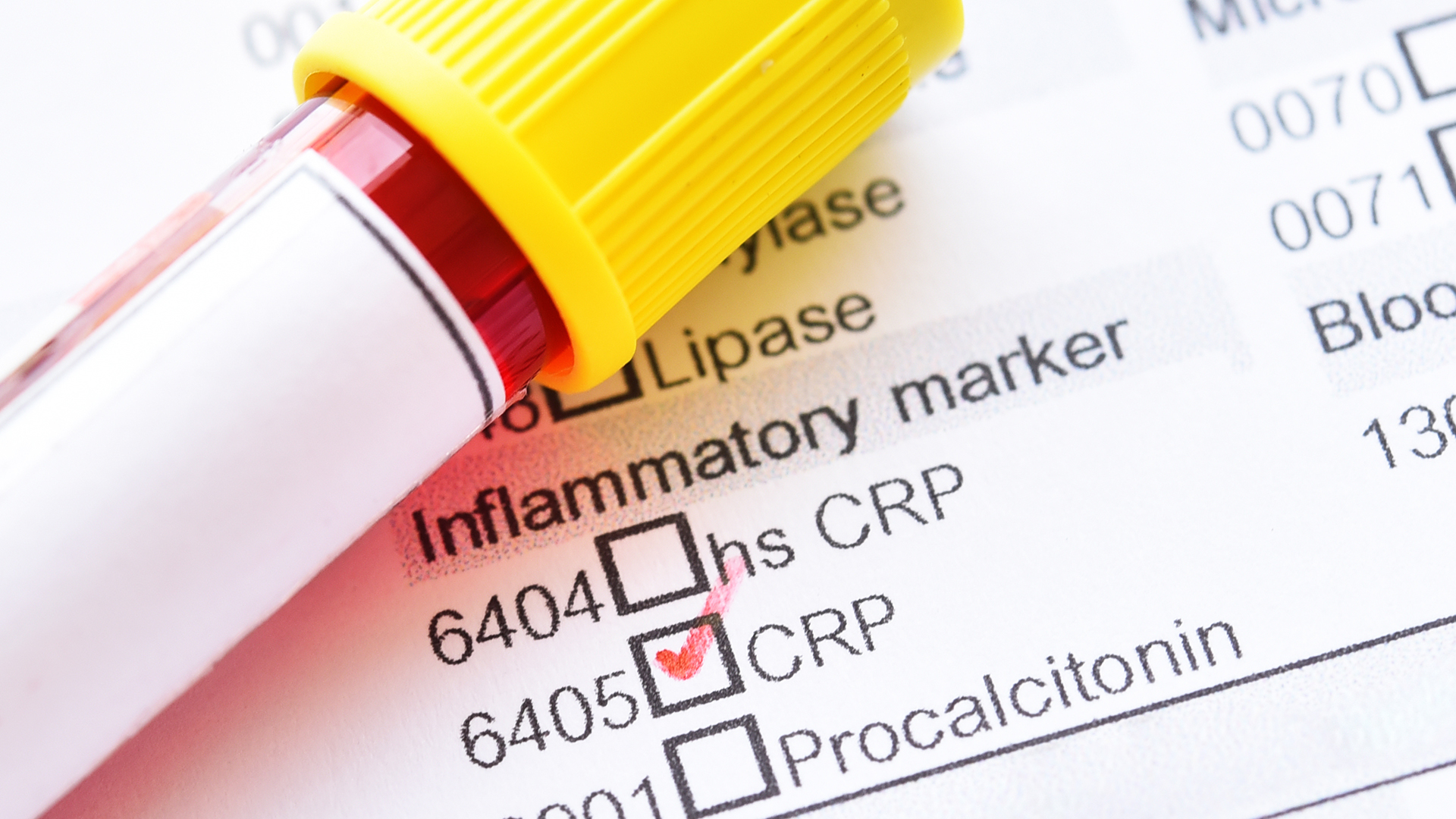 CRP proteins can reduce immune responses in inflammatory disease