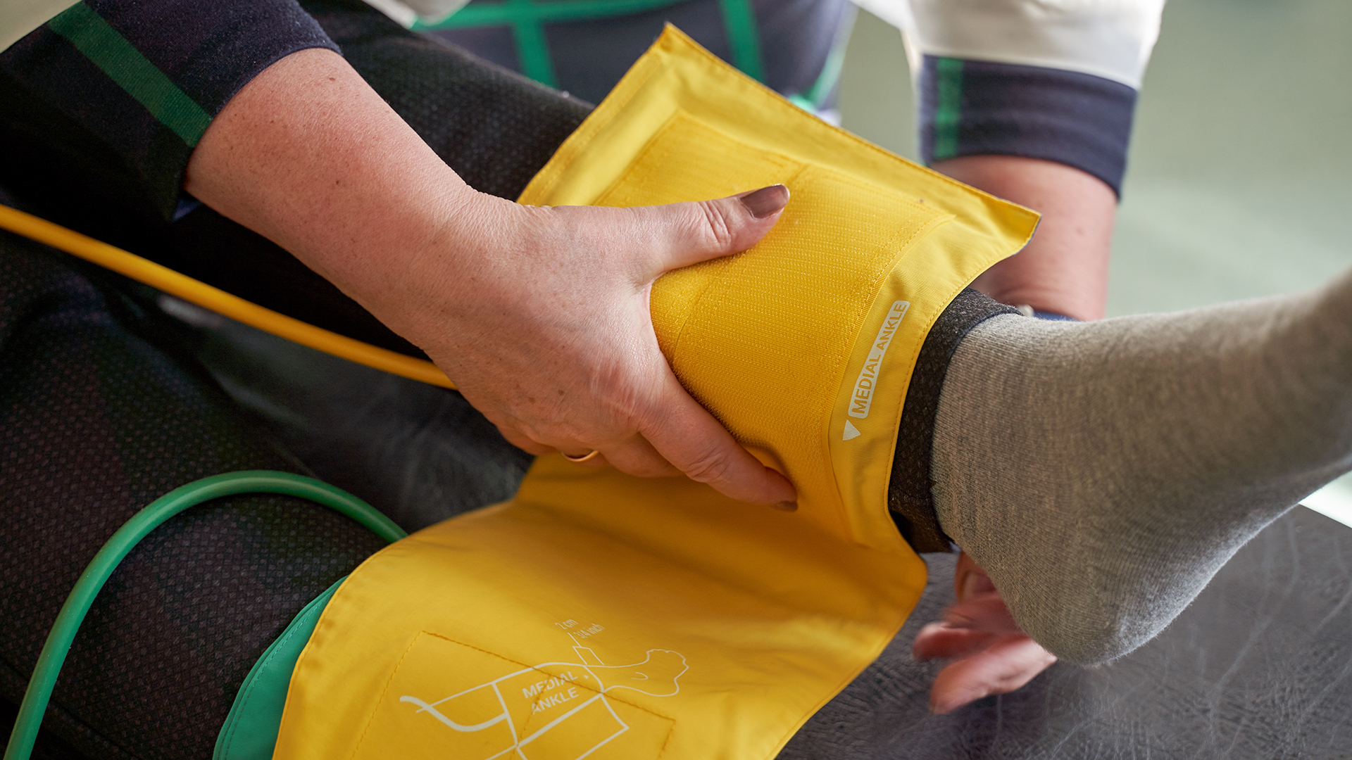 Gender inequality in the treatment of peripheral artery disease