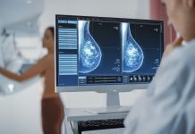 AI breast cancer screening