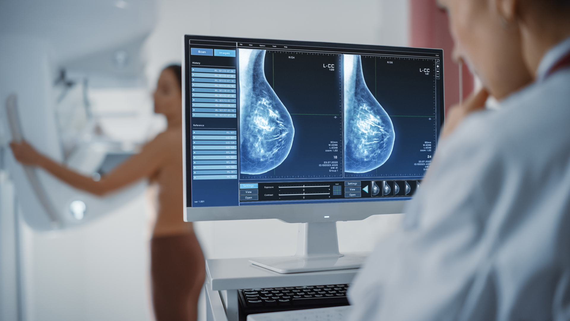 AI breast cancer screening