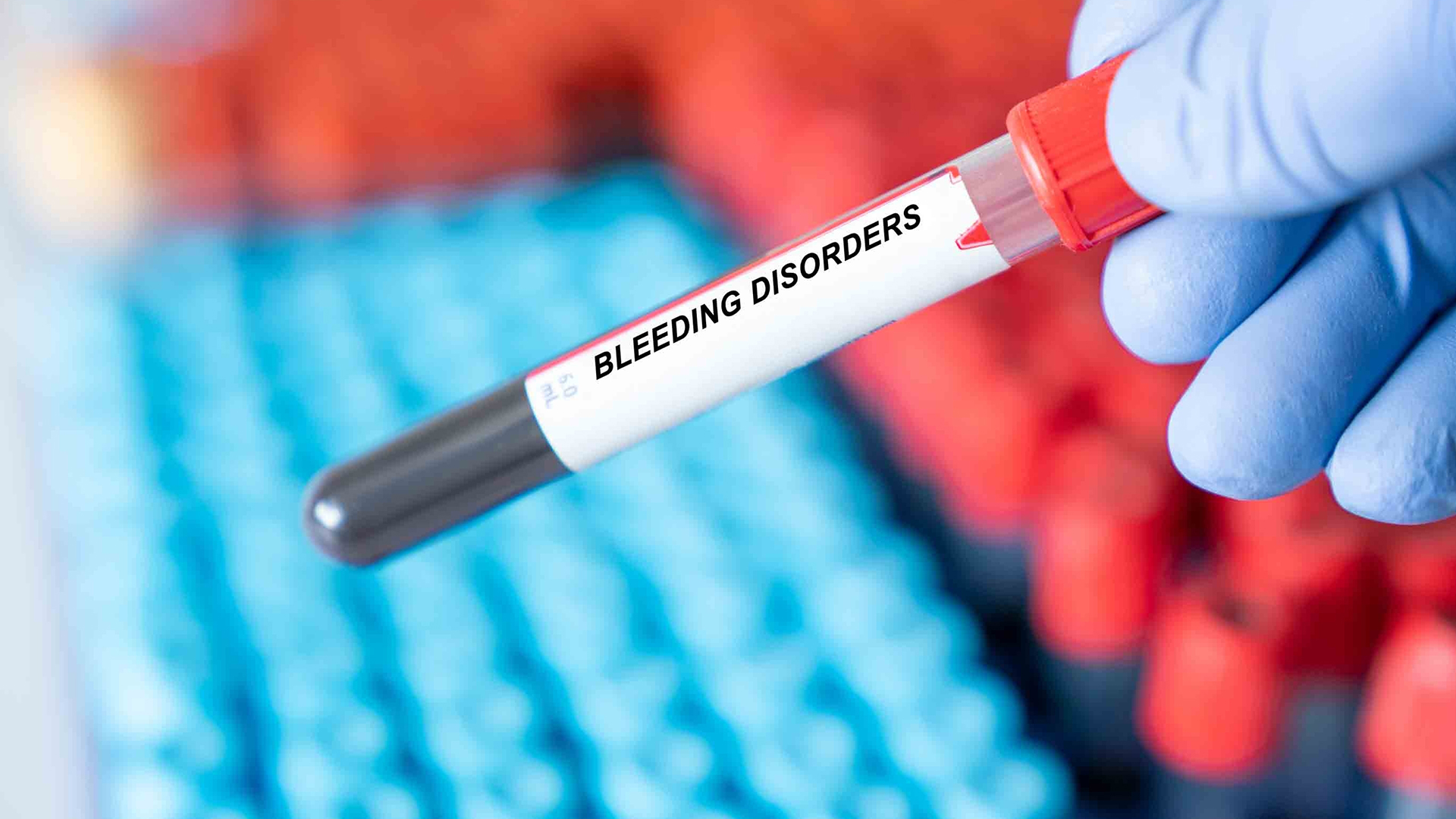 bleeding disorders