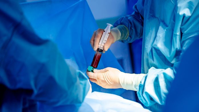 Plasma,In,Syringe.,Specialist,Makes,Injection,With,Syringe.,Profeccional,Treatment. stem cell transplants