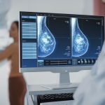 breast cancer risk