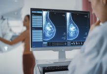 AI-driven screening identifies high breast cancer risk in mammograms breast cancer risk