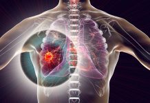 Defence Therapeutics’ breakthrough in cancer treatment: AccuTOX® shows promise against lung tumours lung tumours