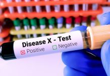 Disease X: Researchers analyse virus ancestry to predict next global pandemic Disease X