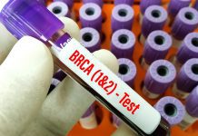 BRCA gene testing programme launched by NHS to identify cancer risk BRCA gene