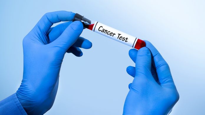 lung cancer blood test